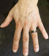 Flat Band on man's hand